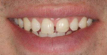 Family, Cosmetic & Implant Dentist in Lexington, KY