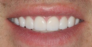 Family, Cosmetic & Implant Dentist in Lexington, KY