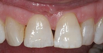 Family, Cosmetic & Implant Dentist in Lexington, KY