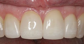 Family, Cosmetic & Implant Dentist in Lexington, KY