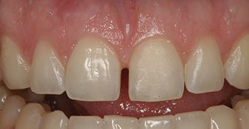 Family, Cosmetic & Implant Dentist in Lexington, KY