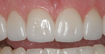 Family, Cosmetic & Implant Dentist in Lexington, KY
