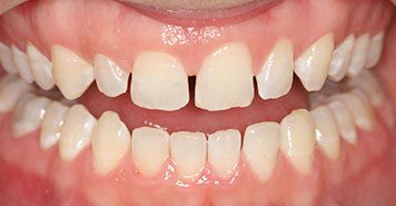 Family, Cosmetic & Implant Dentist in Lexington, KY
