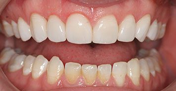 Family, Cosmetic & Implant Dentist in Lexington, KY