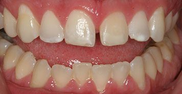 Family, Cosmetic & Implant Dentist in Lexington, KY