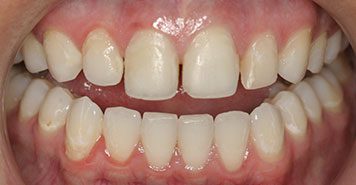 Family, Cosmetic & Implant Dentist in Lexington, KY