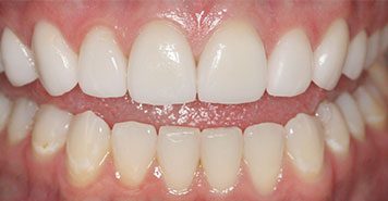 Family, Cosmetic & Implant Dentist in Lexington, KY