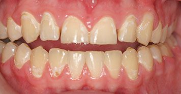 Family, Cosmetic & Implant Dentist in Lexington, KY