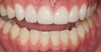 Family, Cosmetic & Implant Dentist in Lexington, KY
