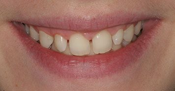 Family, Cosmetic & Implant Dentist in Lexington, KY