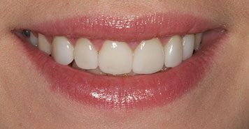 Family, Cosmetic & Implant Dentist in Lexington, KY