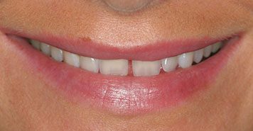 Family, Cosmetic & Implant Dentist in Lexington, KY
