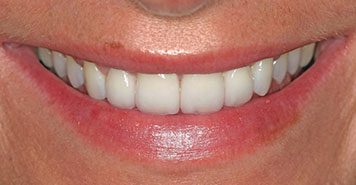 Family, Cosmetic & Implant Dentist in Lexington, KY