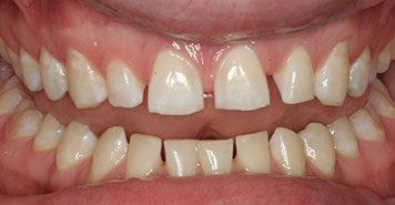 Family, Cosmetic & Implant Dentist in Lexington, KY