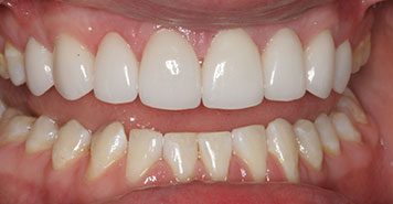 Family, Cosmetic & Implant Dentist in Lexington, KY