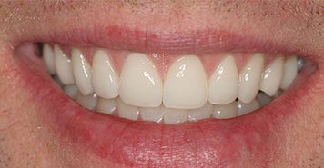 5 star family dentist near Lexington, KY