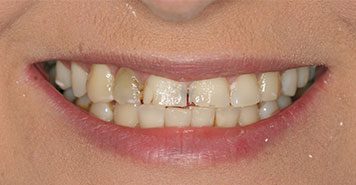 Family, Cosmetic & Implant Dentist in Lexington, KY