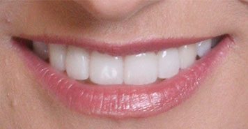 Family, Cosmetic & Implant Dentist in Lexington, KY