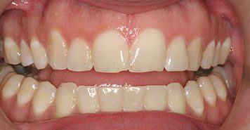 Family, Cosmetic & Implant Dentist in Lexington, KY