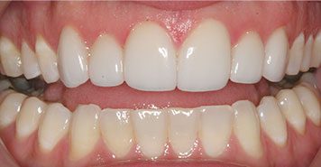 Family, Cosmetic & Implant Dentist in Lexington, KY