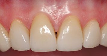 Family, Cosmetic & Implant Dentist in Lexington, KY