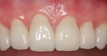 Family, Cosmetic & Implant Dentist in Lexington, KY