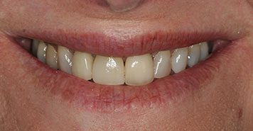 Family, Cosmetic & Implant Dentist in Lexington, KY