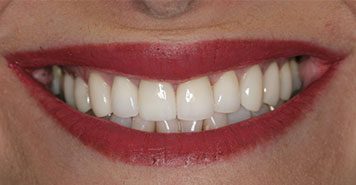 Family, Cosmetic & Implant Dentist in Lexington, KY