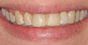 Family, Cosmetic & Implant Dentist in Lexington, KY