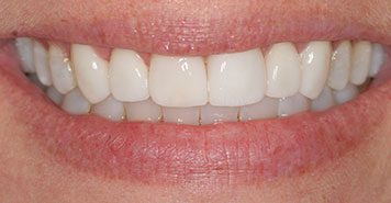 Family, Cosmetic & Implant Dentist in Lexington, KY