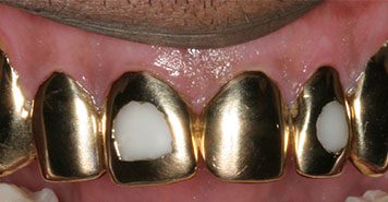 Family, Cosmetic & Implant Dentist in Lexington, KY