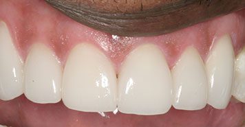 Family, Cosmetic & Implant Dentist in Lexington, KY