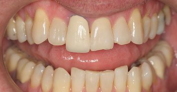 Family, Cosmetic & Implant Dentist in Lexington, KY