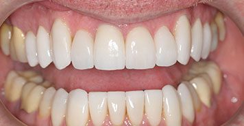 Family, Cosmetic & Implant Dentist in Lexington, KY