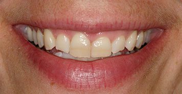 Family, Cosmetic & Implant Dentist in Lexington, KY