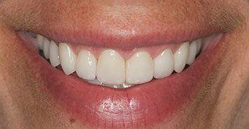 Family, Cosmetic & Implant Dentist in Lexington, KY