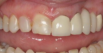 Family, Cosmetic & Implant Dentist in Lexington, KY
