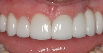 Family, Cosmetic & Implant Dentist in Lexington, KY