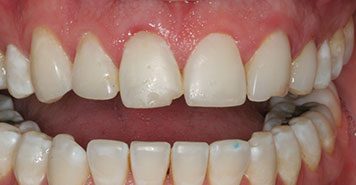 Family, Cosmetic & Implant Dentist in Lexington, KY