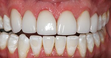 Family, Cosmetic & Implant Dentist in Lexington, KY