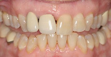 Family, Cosmetic & Implant Dentist in Lexington, KY