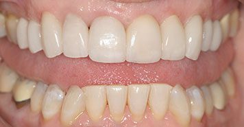 Family, Cosmetic & Implant Dentist in Lexington, KY