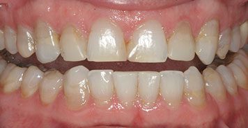 Family, Cosmetic & Implant Dentist in Lexington, KY