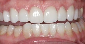 Family, Cosmetic & Implant Dentist in Lexington, KY