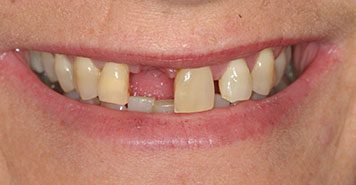 Family, Cosmetic & Implant Dentist in Lexington, KY
