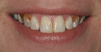 Family, Cosmetic & Implant Dentist in Lexington, KY