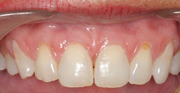 Family, Cosmetic & Implant Dentist in Lexington, KY