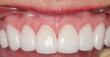 Family, Cosmetic & Implant Dentist in Lexington, KY