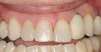 Family, Cosmetic & Implant Dentist in Lexington, KY