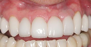 Family, Cosmetic & Implant Dentist in Lexington, KY